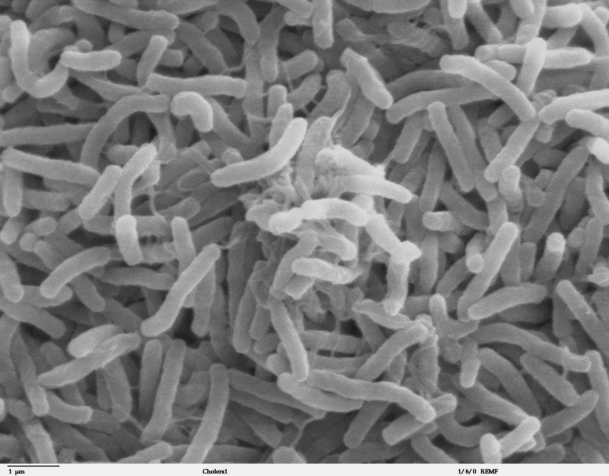 https://medbul.net/wp-content/uploads/2020/11/Cholera_bacteria_SEM.jpg