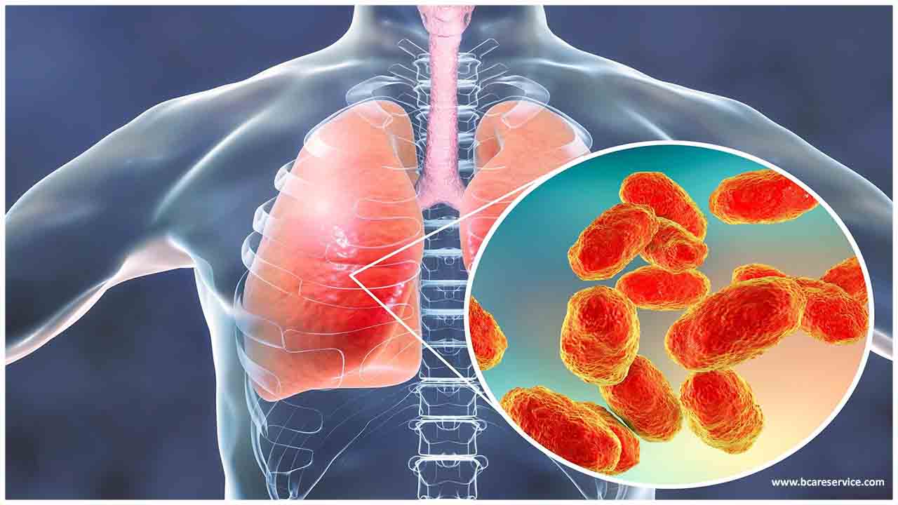 Бактериална пневмония: симптоми и лечение