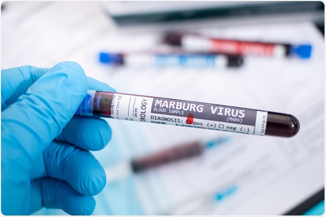 Марбургски вирус
